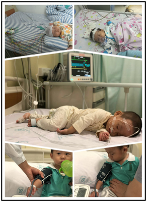 อิเล็กโทรดดูด EKG อเนกประสงค์ 40421A สำหรับกล้วย 4.0 Din 3.0 Snap